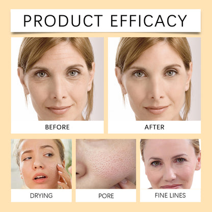 Turmeric & Kojic Soap